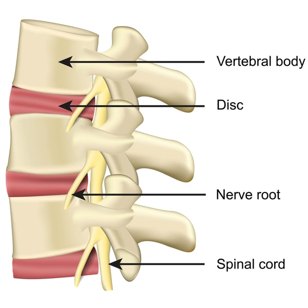 neurogenic-claudication-healthplexus